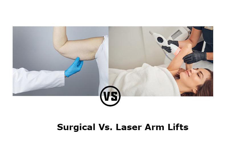 Surgical Vs. Laser Arm Lifts - Which Is Best?
