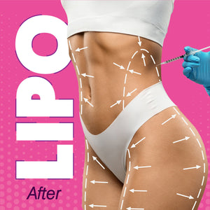 After Liposuction